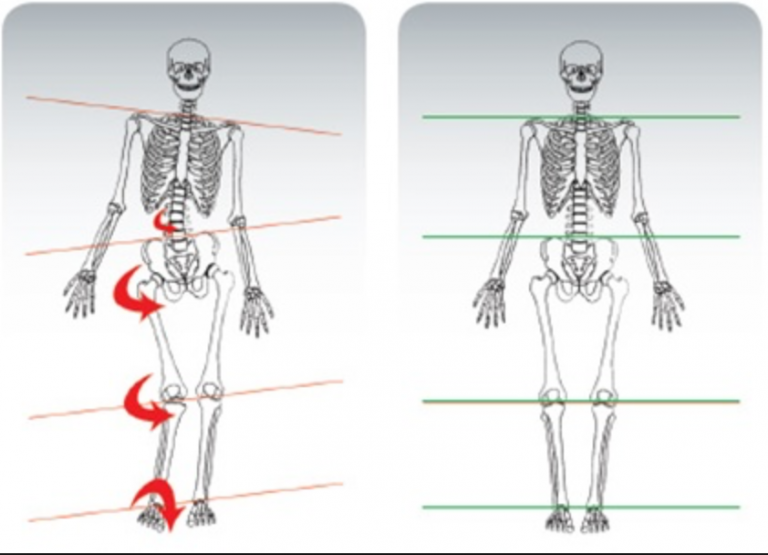 Why The Pelvis Should Be The First Place You Look When Assessing ...